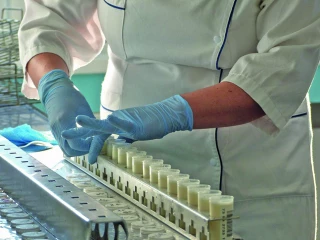 Échantillon de lait : une mine d’informations pour mieux piloter son troupeau